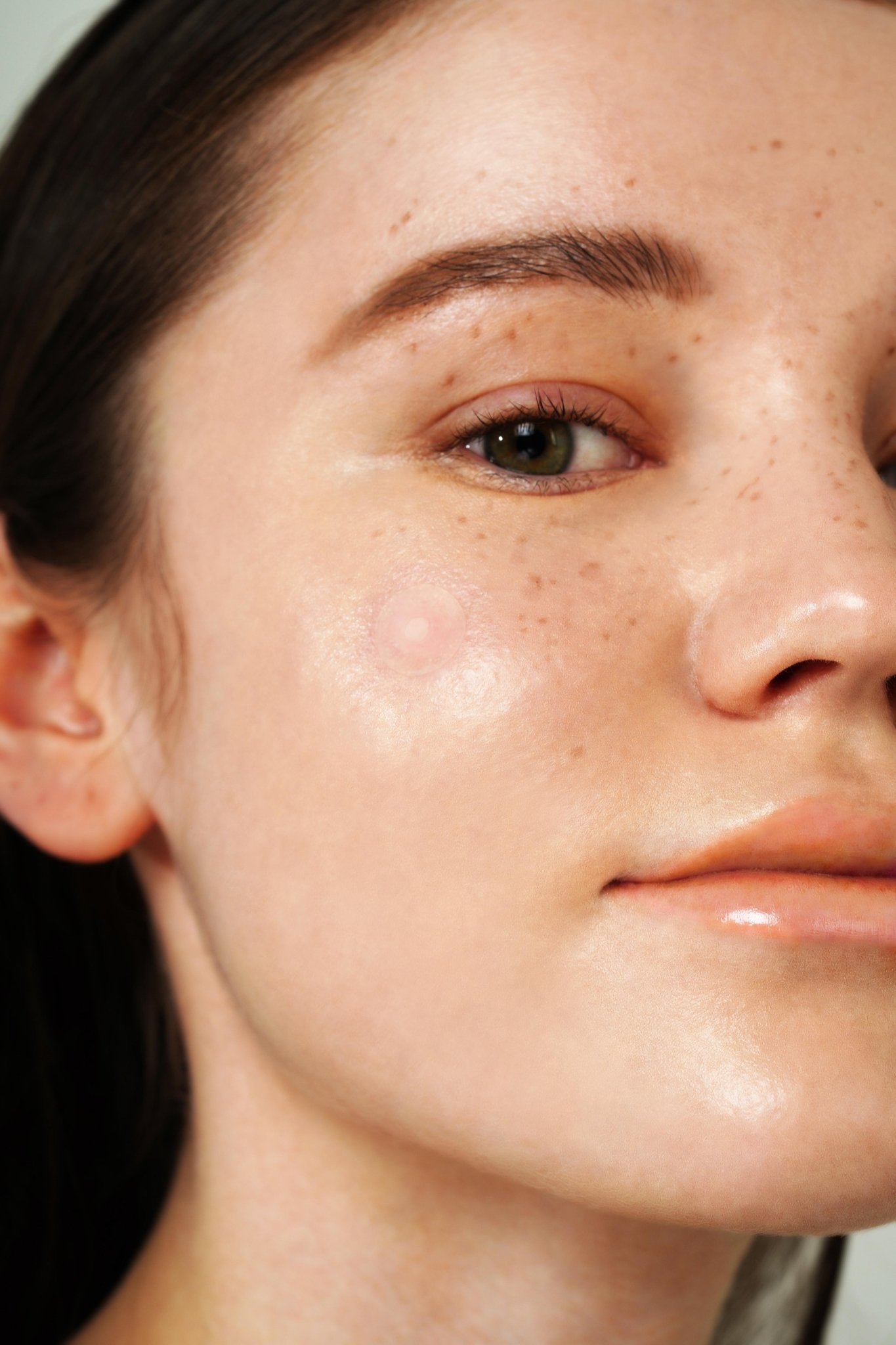 Isntree - Onion Newpair Spot Patch (24ea) - Skin Shine