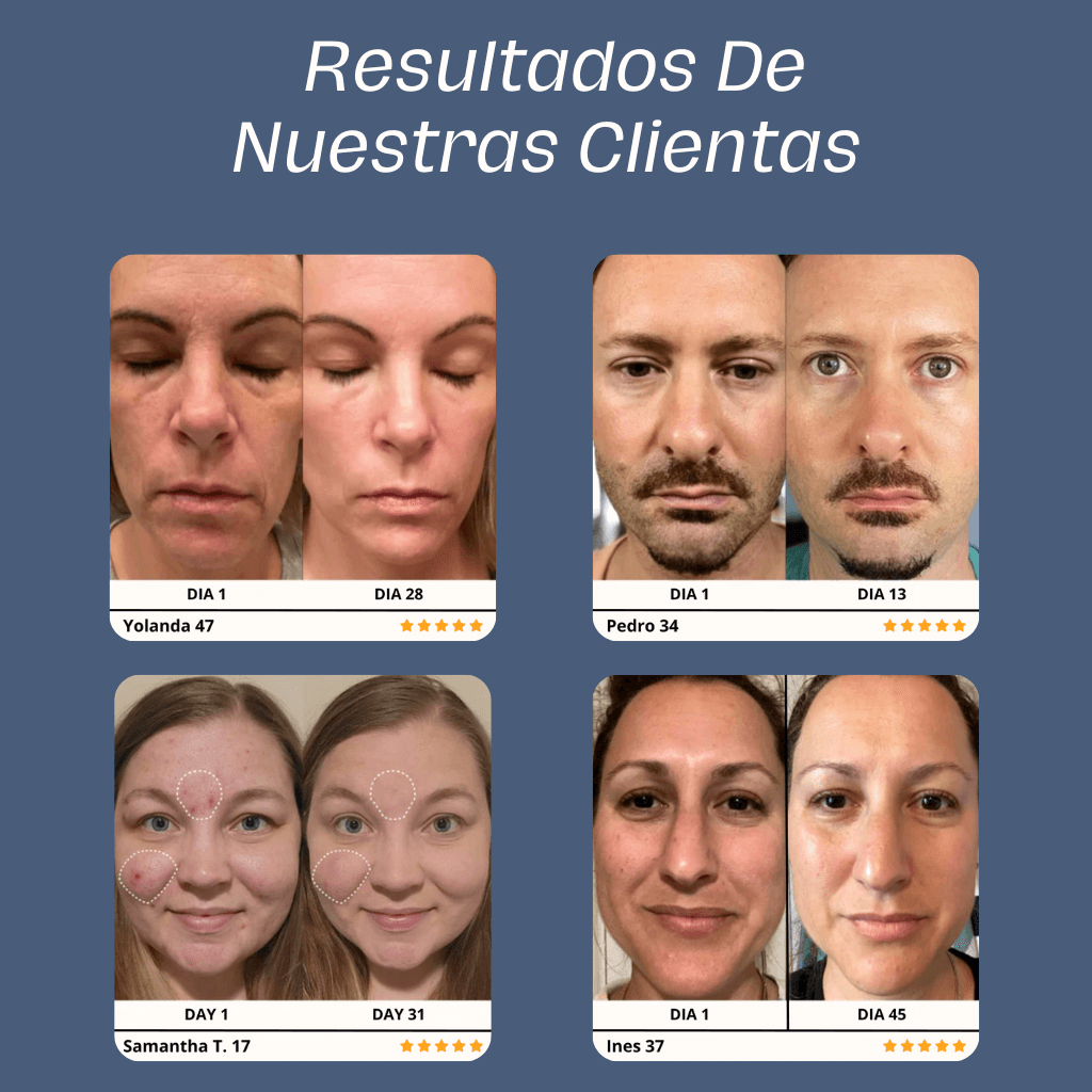 Skin Glow 3.0™ | El Mejor Aliado Para Tu Piel