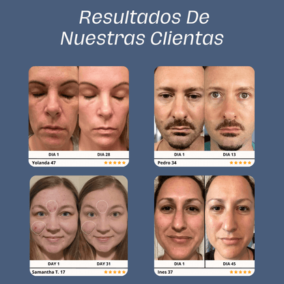Skin Glow 3.0™ | El Mejor Aliado Para Tu Piel