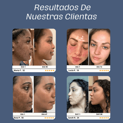 Skin Glow 3.0™ | El Mejor Aliado Para Tu Piel